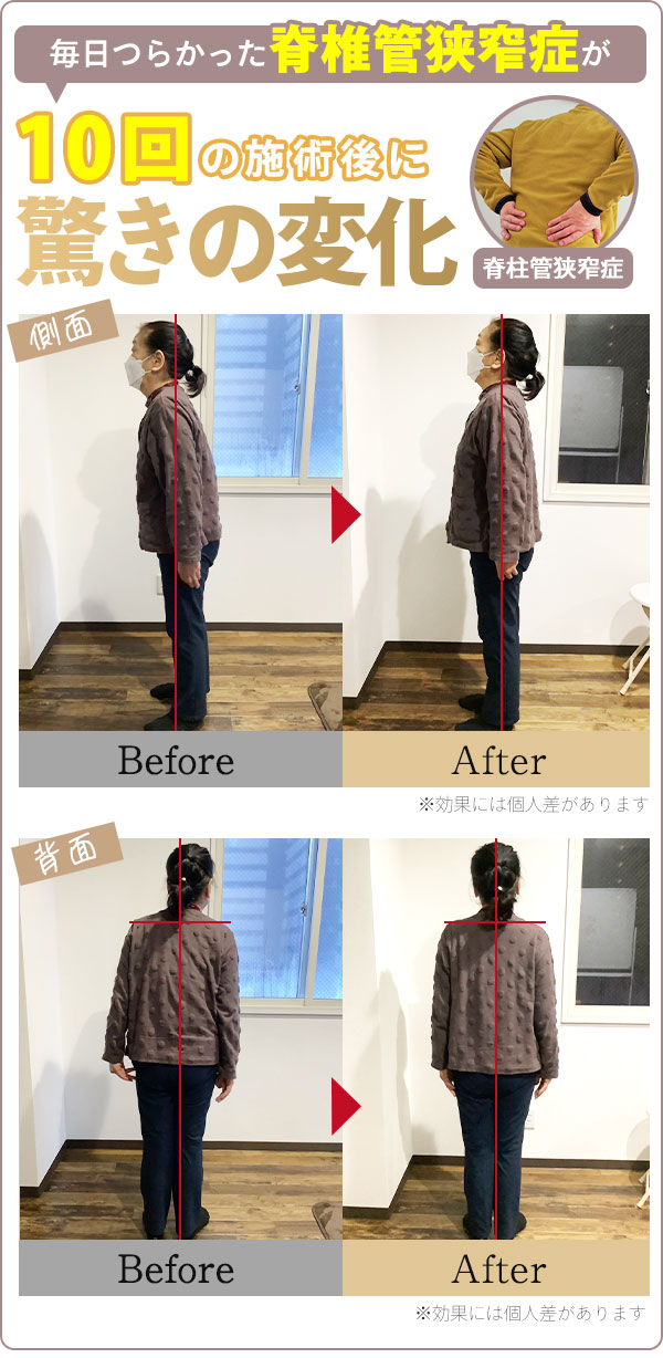 ビフォーアフター